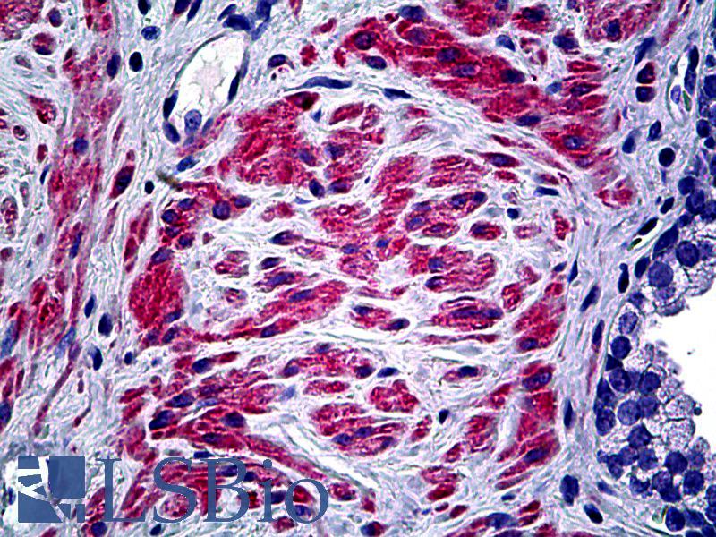 COL5A2 / Collagen V Alpha 2 Antibody - Anti-COL5A2 antibody IHC of human prostate. Immunohistochemistry of formalin-fixed, paraffin-embedded tissue after heat-induced antigen retrieval. Antibody dilution 1:100.