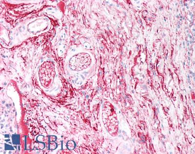 COL5A2 / Collagen V Alpha 2 Antibody - Human Tonsil, Soft Tissue: Formalin-Fixed, Paraffin-Embedded (FFPE)