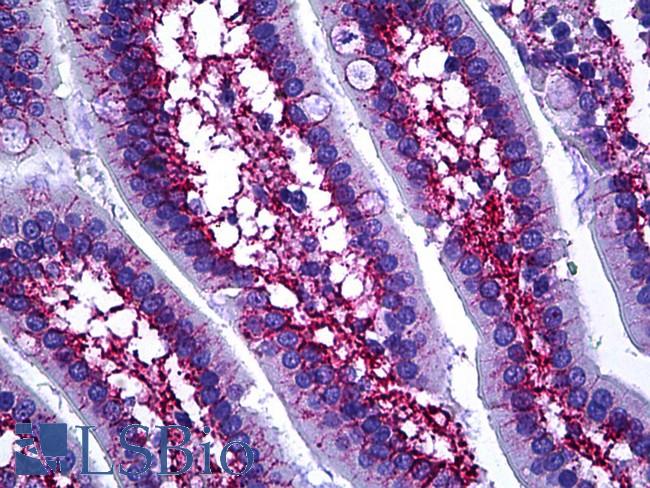 COL6A1 / Collagen VI Alpha 1 Antibody - Anti-COL6A1 antibody IHC of human intestine. Immunohistochemistry of formalin-fixed, paraffin-embedded tissue after heat-induced antigen retrieval. Antibody dilution 1:100.