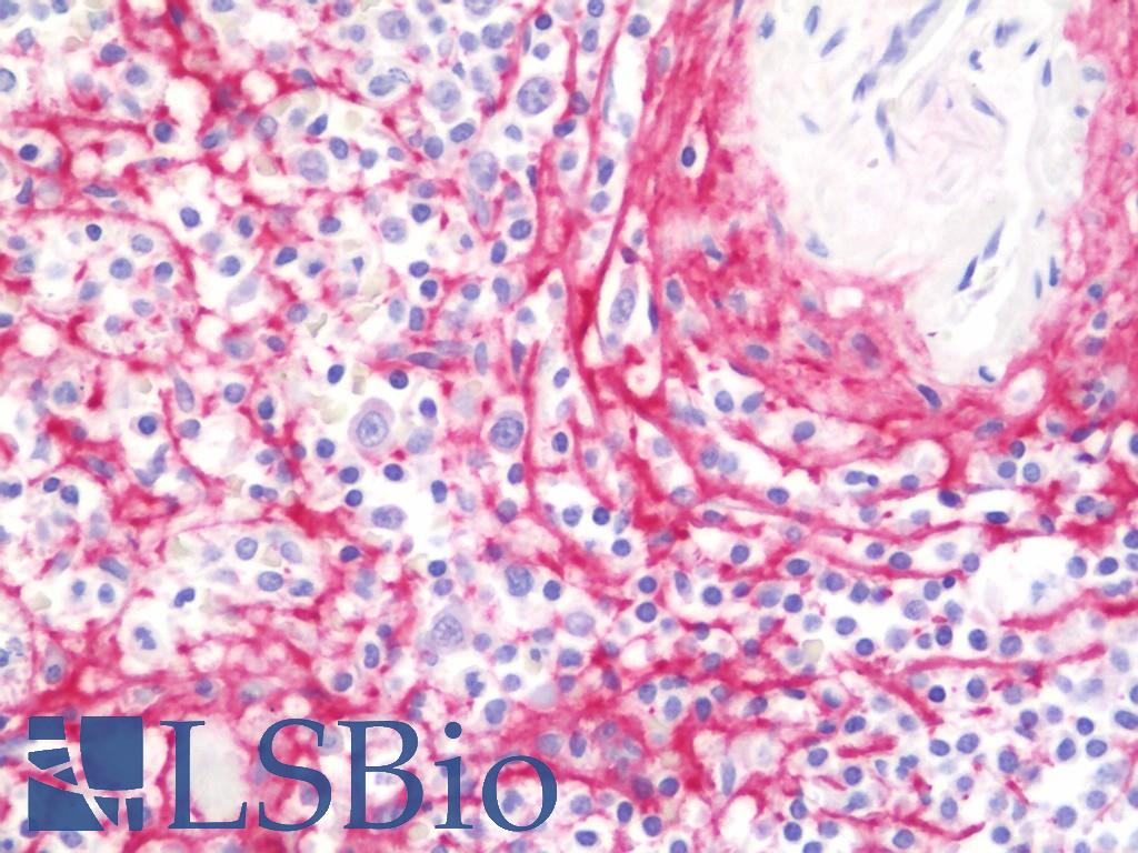COL6A2 / Collagen VI Alpha 2 Antibody - Anti-COL6A2 / Collagen VI antibody IHC staining of human spleen. Immunohistochemistry of formalin-fixed, paraffin-embedded tissue after heat-induced antigen retrieval. Antibody concentration 10 ug/ml.