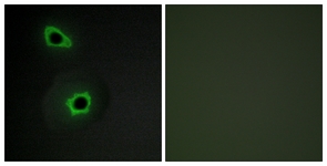COL7A1 / Collagen VII Antibody - Immunofluorescence of COS7 cells, using Collagen VII alpha1 Antibody. The sample on the right was incubated with synthetic peptide.