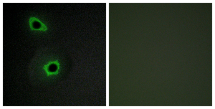 COL7A1 / Collagen VII Antibody - Immunofluorescence analysis of COS7 cells, using Collagen VII alpha1 Antibody. The picture on the right is blocked with the synthesized peptide.