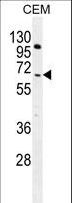 COL8A2 / Collagen VIII Antibody - COL8A2 Antibody western blot of CEM cell line lysates (35 ug/lane). The COL8A2 antibody detected the COL8A2 protein (arrow).