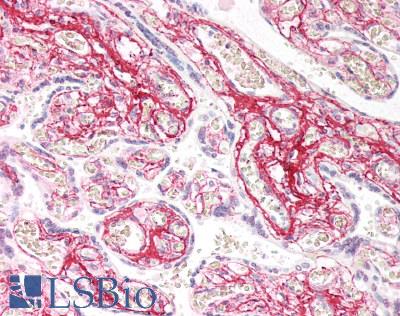 Collagen II Antibody - Human Placenta: Formalin-Fixed, Paraffin-Embedded (FFPE)