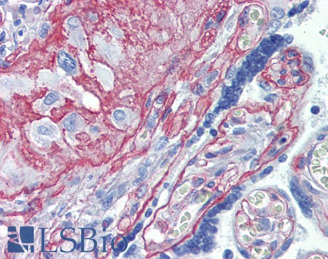 Collagen IV Antibody - Anti-Collagen IV antibody IHC of human placenta. Immunohistochemistry of formalin-fixed, paraffin-embedded tissue after heat-induced antigen retrieval. Antibody dilution 1:100.