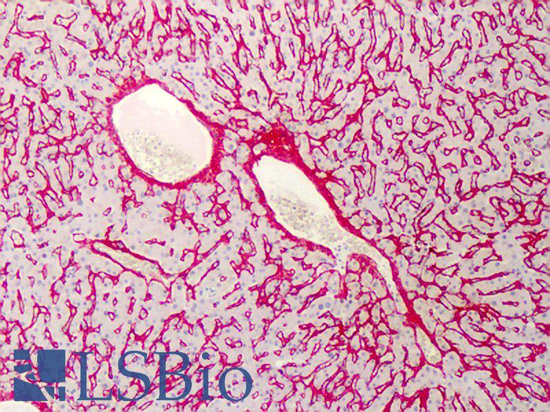 Collagen VI Antibody - Anti-Collagen VI antibody IHC of human liver. Immunohistochemistry of formalin-fixed, paraffin-embedded tissue after heat-induced antigen retrieval. Antibody concentration 1.25 ug/ml. This image was taken for the unconjugated form of this product. Other forms have not been tested.