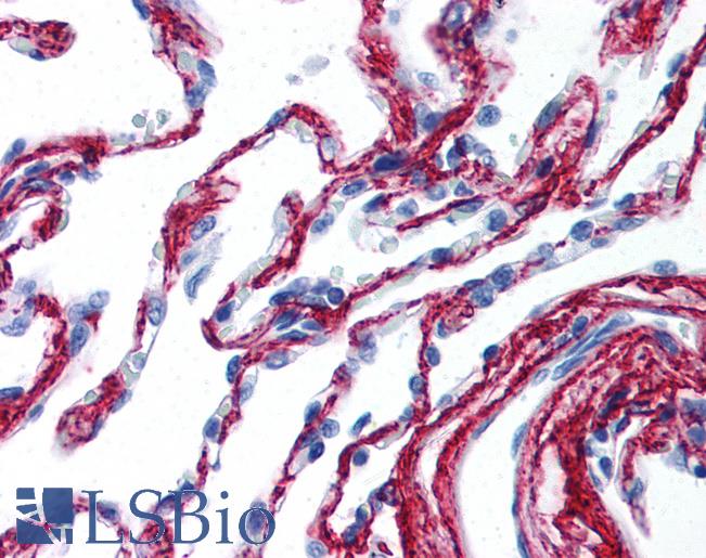 Collagen VI Antibody - Anti-Collagen VI antibody IHC of human lung. Immunohistochemistry of formalin-fixed, paraffin-embedded tissue after heat-induced antigen retrieval. Antibody concentration 5 ug/ml.