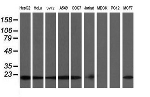 COMMD1 Antibody - Western blot of extracts (35 ug) from 9 different cell lines by using g anti-COMMD1 monoclonal antibody (HepG2: human; HeLa: human; SVT2: mouse; A549: human; COS7: monkey; Jurkat: human; MDCK: canine; PC12: rat; MCF7: human).