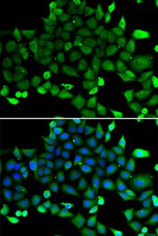 COMMD1 Antibody - Immunofluorescence analysis of A549 cells.