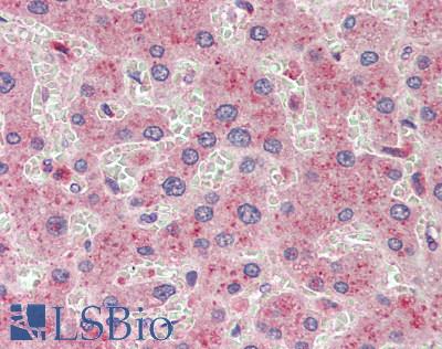 COMMD1 Antibody - Human Liver: Formalin-Fixed, Paraffin-Embedded (FFPE)