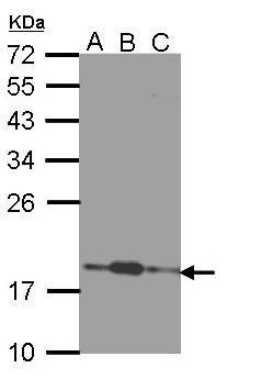 COMMD7 Antibody - Sample (30 ug of whole cell lysate). A:293T, B: A431 , C: H1299. 12% SDS PAGE. COMMD7 antibody diluted at 1:1000.