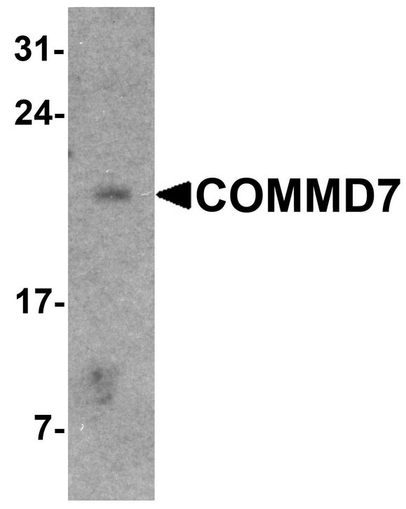 COMMD7 Antibody - Western blot analysis of COMMD7 in mouse spleen tissue lysate with COMMD7 antibody at 1 ug/ml.