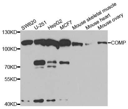 COMP / THBS5 Antibody - Western blot analysis of extracts of various cell lines, using COMP antibody.