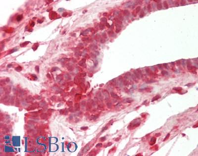 COMP / THBS5 Antibody - Human Breast: Formalin-Fixed, Paraffin-Embedded (FFPE)