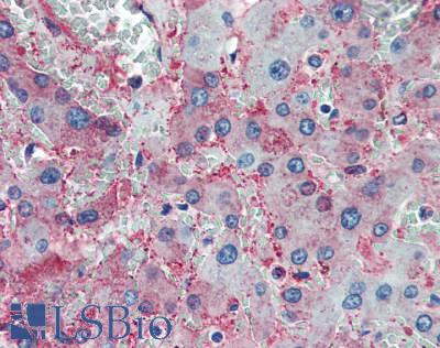 Complement C1q Antibody - Human Liver: Formalin-Fixed, Paraffin-Embedded (FFPE)