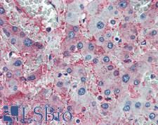 Complement C1q Antibody - Human Liver: Formalin-Fixed, Paraffin-Embedded (FFPE)
