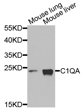 Complement C1QA Antibody - Western blot analysis of extracts of various cells.