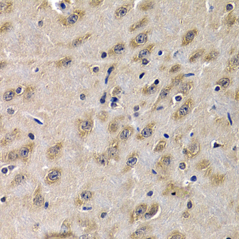 Complement C1QA Antibody - Immunohistochemistry of paraffin-embedded mouse brain tissue.
