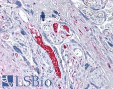 Complement C1QA Antibody - Human Placenta: Formalin-Fixed, Paraffin-Embedded (FFPE)