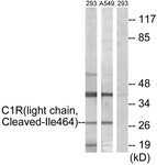 Complement C1R Antibody - Western blot of extracts from 293/A549 cells, treated with etoposide 25 uM 1h, using  Complement C1R Antibody. The lane on the right is treated with the synthesized peptide.