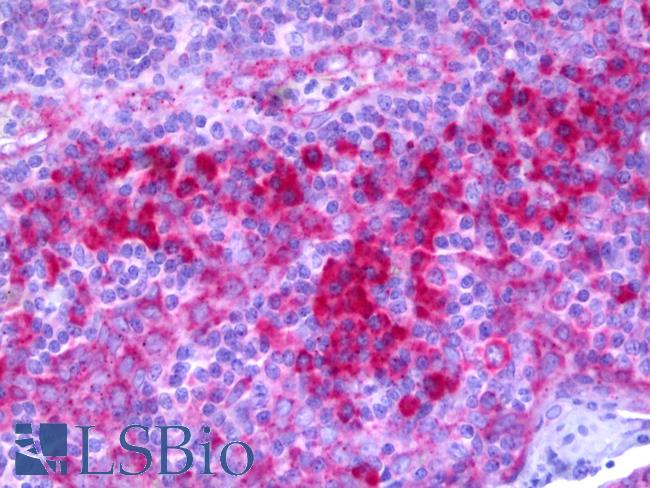 Complement C1R Antibody - Anti-C1R / Complement C1r antibody IHC of human tonsil. Immunohistochemistry of formalin-fixed, paraffin-embedded tissue after heat-induced antigen retrieval. Antibody dilution 1:200.
