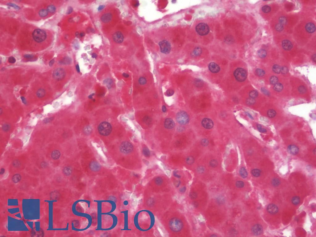 Complement C1s Antibody - Anti-Complement C1s antibody IHC staining of human liver. Immunohistochemistry of formalin-fixed, paraffin-embedded tissue after heat-induced antigen retrieval. Antibody concentration 10 ug/ml.