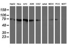 Complement C1s Antibody - Western blot of extracts (35 ug) from 9 different cell lines by using anti-C1S monoclonal antibody (HepG2: human; HeLa: human; SVT2: mouse; A549: human; COS7: monkey; Jurkat: human; MDCK: canine; PC12: rat; MCF7: human).