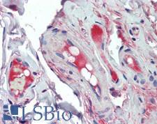Complement C2 Antibody - Human Small Intestine, Vessels: Formalin-Fixed, Paraffin-Embedded (FFPE)