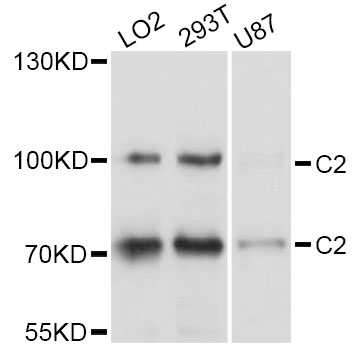 Complement C2 Antibody - Western blot analysis of extracts of various cell lines, using C2 antibody at 1:1000 dilution. The secondary antibody used was an HRP Goat Anti-Rabbit IgG (H+L) at 1:10000 dilution. Lysates were loaded 25ug per lane and 3% nonfat dry milk in TBST was used for blocking. An ECL Kit was used for detection and the exposure time was 5s.