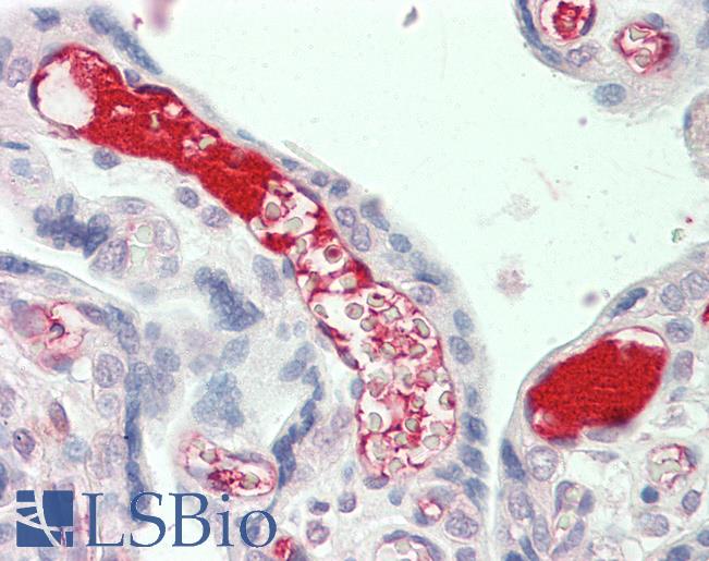 Complement C3 Antibody - Anti-Complement C3 antibody IHC staining of human placenta. Immunohistochemistry of formalin-fixed, paraffin-embedded tissue after heat-induced antigen retrieval.