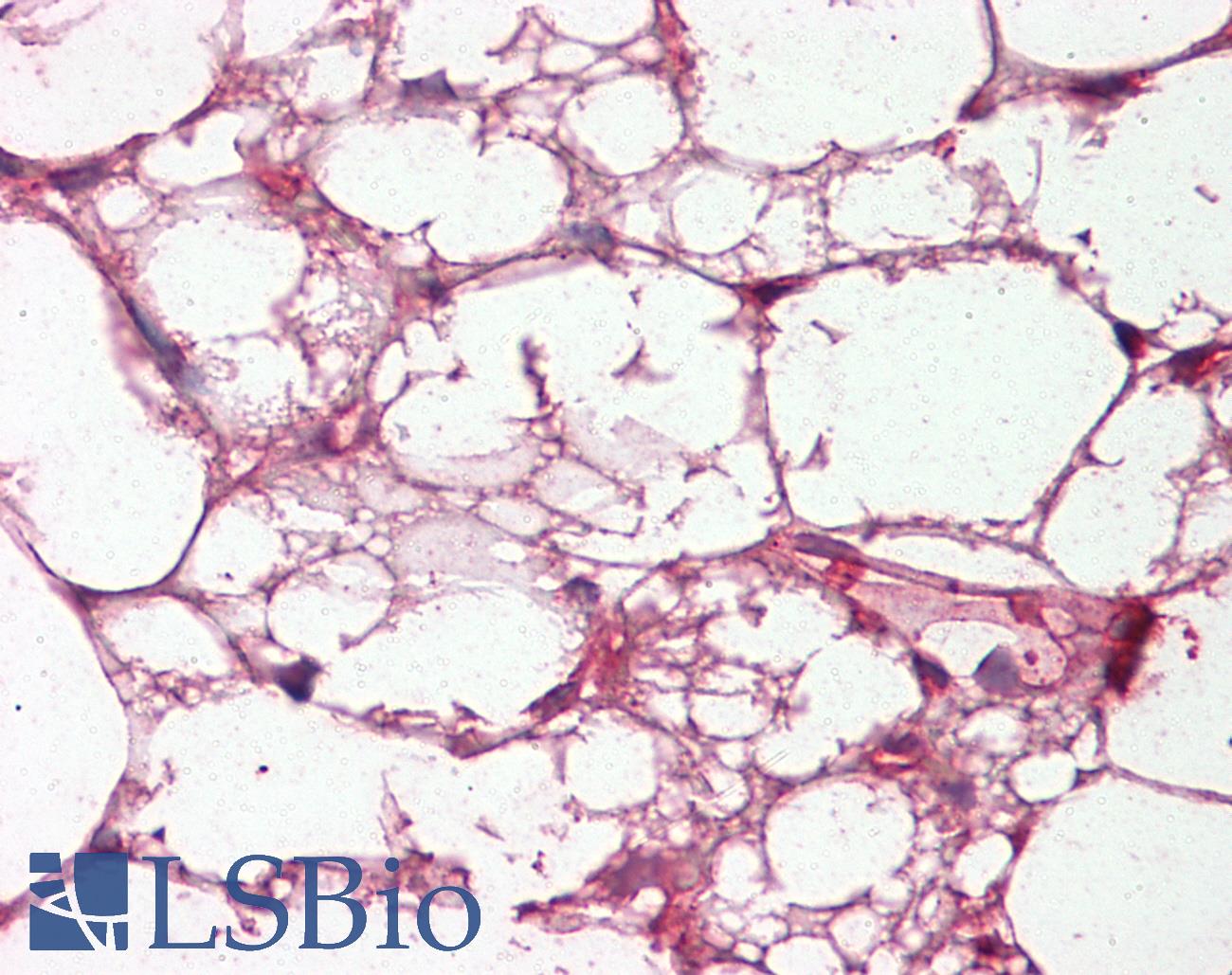 Complement C3c Antibody - Anti-Complement C3/C3c antibody IHC of human adrenal, adipocytes. Immunohistochemistry of formalin-fixed, paraffin-embedded tissue after heat-induced antigen retrieval. Antibody dilution 1:200.