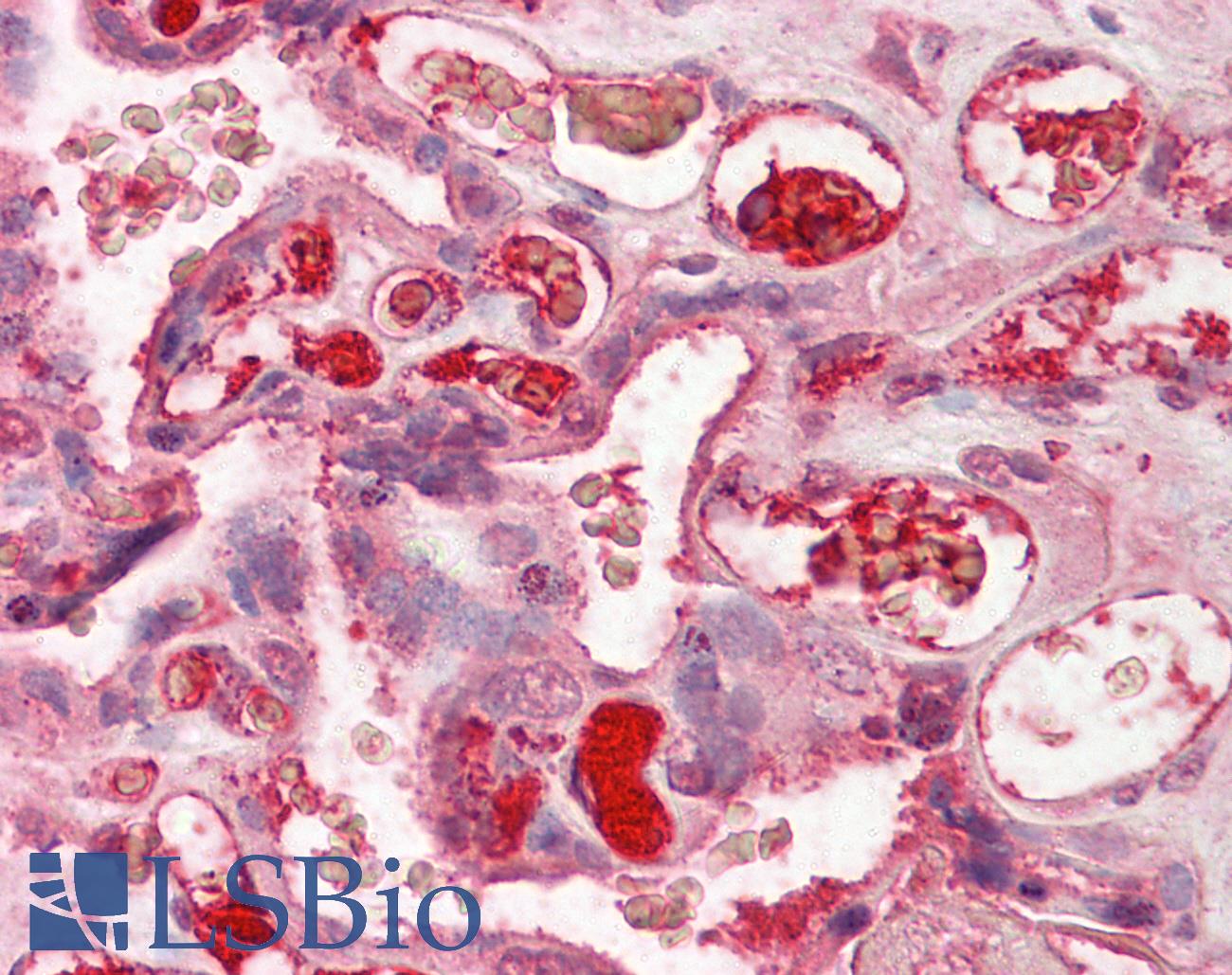 Complement C3c Antibody - Anti-Complement C3/C3c antibody IHC of human placenta. Immunohistochemistry of formalin-fixed, paraffin-embedded tissue after heat-induced antigen retrieval. Antibody dilution 1:200.