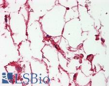 Complement C3c Antibody - Anti-Complement C3/C3c antibody IHC of human adrenal, adipocytes. Immunohistochemistry of formalin-fixed, paraffin-embedded tissue after heat-induced antigen retrieval. Antibody dilution 1:200.