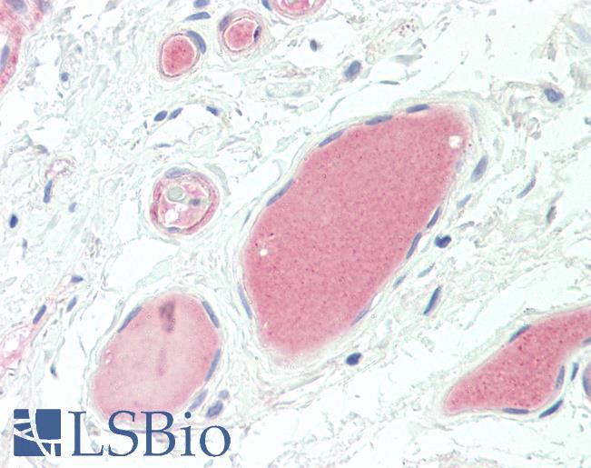 Complement C3d Antibody - Anti-Complement C3d antibody IHC staining of human vessels. Immunohistochemistry of formalin-fixed, paraffin-embedded tissue after heat-induced antigen retrieval.