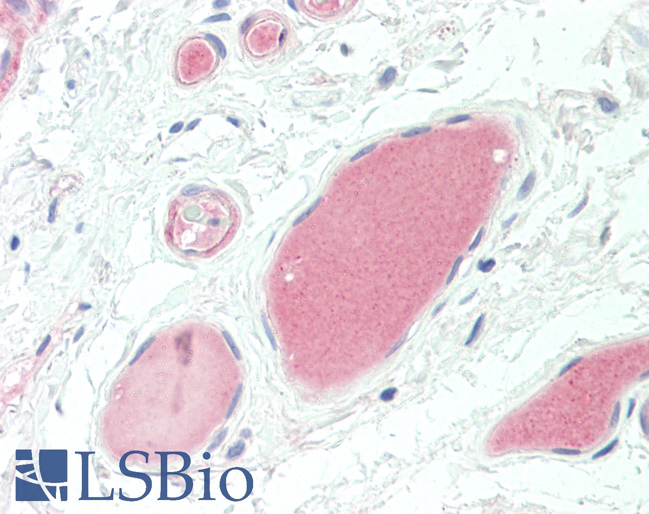 Complement C3d Antibody - Anti-Complement C3d antibody IHC staining of human vessels. Immunohistochemistry of formalin-fixed, paraffin-embedded tissue after heat-induced antigen retrieval.