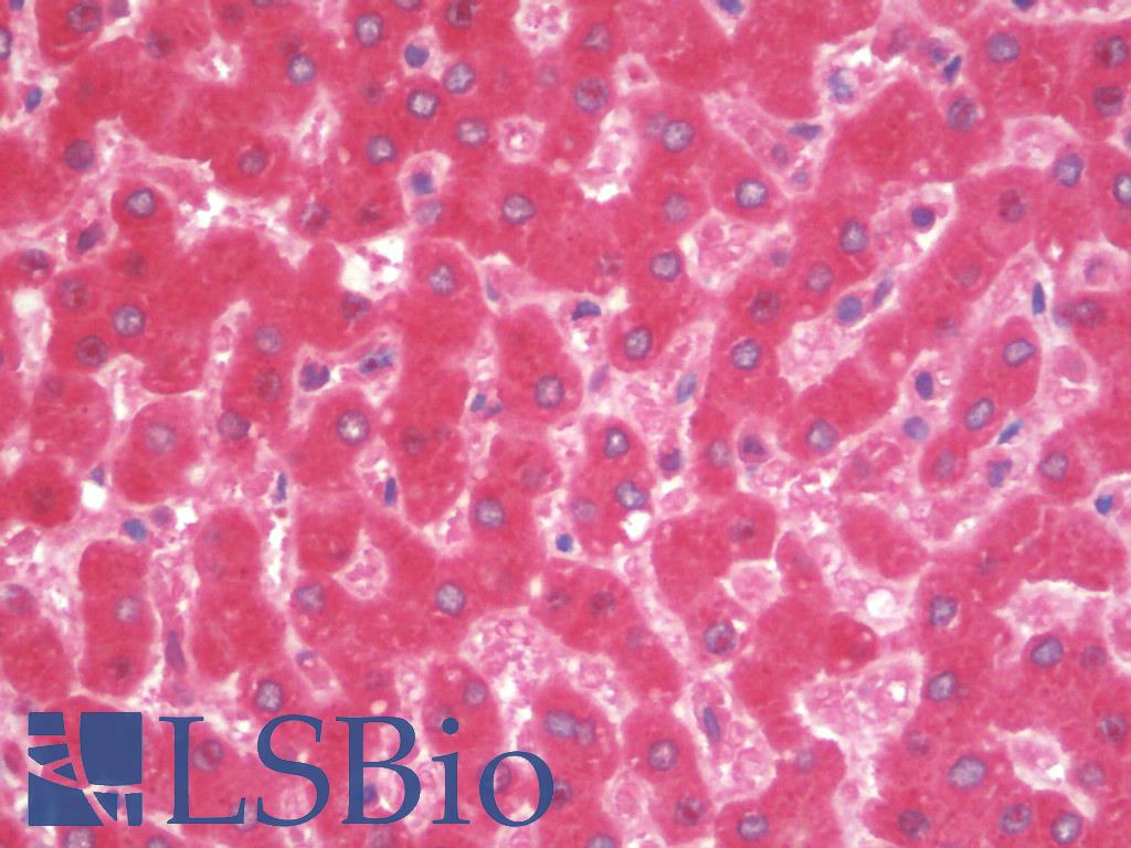 Complement C4 Antibody - Anti-Complement C4b antibody IHC staining of human liver. Immunohistochemistry of formalin-fixed, paraffin-embedded tissue after heat-induced antigen retrieval. Antibody dilution 1:100.