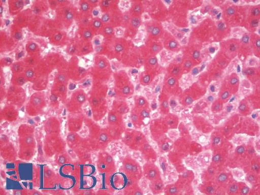 Complement C4 Antibody - Anti-Complement C4b antibody IHC staining of human liver. Immunohistochemistry of formalin-fixed, paraffin-embedded tissue after heat-induced antigen retrieval. Antibody dilution 1:100.
