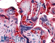Complement C4b Antibody - Anti-C4B antibody IHC of human placenta. Immunohistochemistry of formalin-fixed, paraffin-embedded tissue after heat-induced antigen retrieval. Antibody concentration 20 ug/ml.