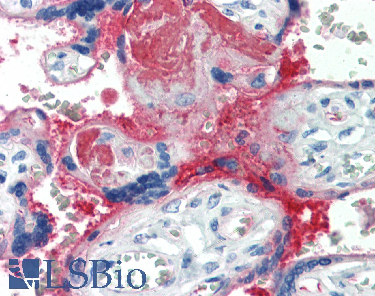 Complement C4d Antibody - Anti-C4d antibody IHC of human placenta. Immunohistochemistry of formalin-fixed, paraffin-embedded tissue after heat-induced antigen retrieval. Antibody dilution 1:25.