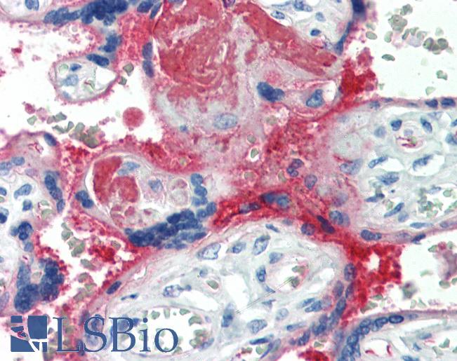 Complement C4d Antibody - Anti-C4d antibody IHC of human placenta. Immunohistochemistry of formalin-fixed, paraffin-embedded tissue after heat-induced antigen retrieval. Antibody dilution 1:25.