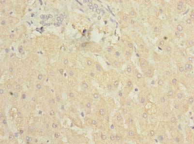 Complement C5 Antibody - Immunohistochemistry of paraffin-embedded human liver tissue using antibody at dilution of 1:100.