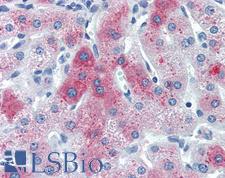 Complement C6 Antibody - Anti-C6 / Complement C6 antibody IHC of human liver. Immunohistochemistry of formalin-fixed, paraffin-embedded tissue after heat-induced antigen retrieval. Antibody concentration 10 ug/ml.