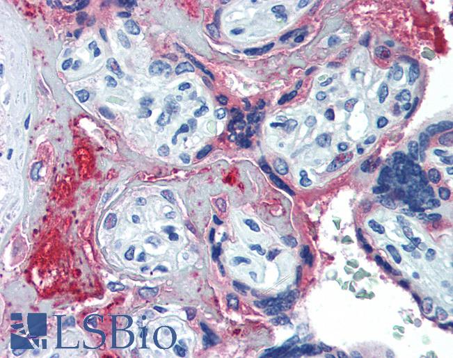 Complement C6 Antibody - Anti-C6 / Complement C6 antibody IHC of human placenta. Immunohistochemistry of formalin-fixed, paraffin-embedded tissue after heat-induced antigen retrieval. Antibody concentration 10 ug/ml.