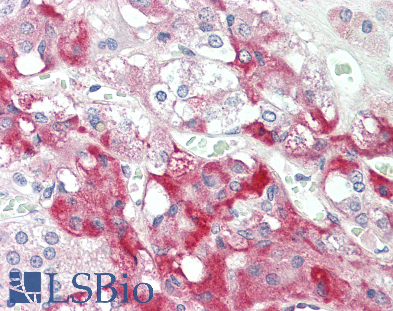 Complement C7 Antibody - Anti-Complement C7 antibody IHC staining of human adrenal. Immunohistochemistry of formalin-fixed, paraffin-embedded tissue after heat-induced antigen retrieval. Antibody concentration 5 ug/ml.