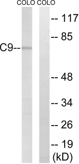 Complement C9 Antibody - Western blot analysis of lysates from COLO cells, using C9 Antibody. The lane on the right is blocked with the synthesized peptide.