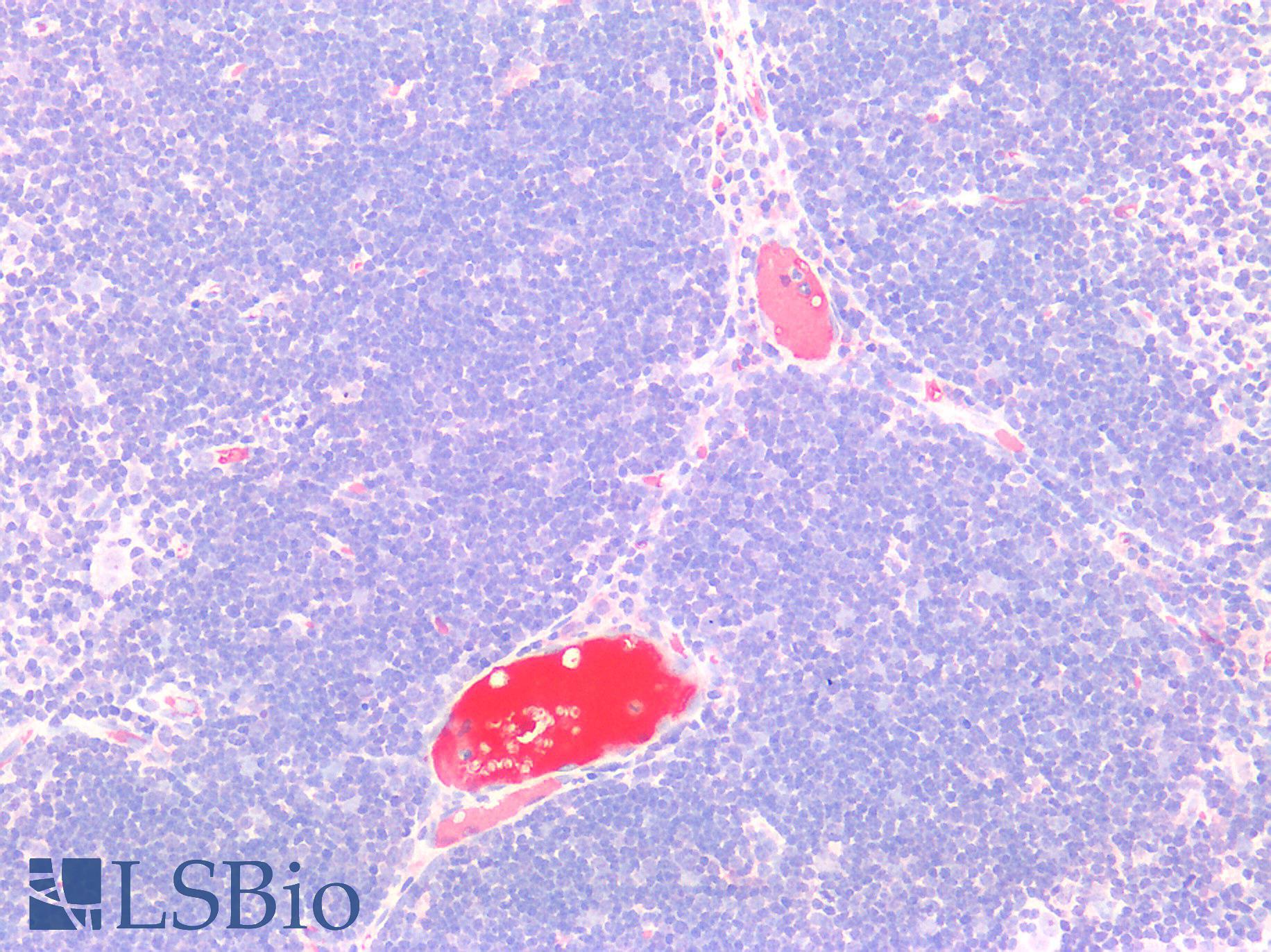 Complement C9 Antibody - Human Thymus: Formalin-Fixed, Paraffin-Embedded (FFPE)