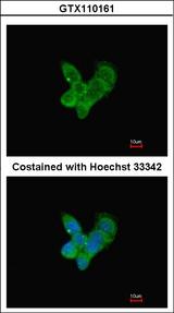 Complement C9 Antibody - Immunofluorescence of methanol-fixed HepG2, using Complement C9 antibody at 1:200 dilution.
