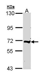 Complement C9 Antibody - Sample (30 ug of whole cell lysate). A: Raji. 7.5% SDS PAGE. C9 antibody diluted at 1:500. 