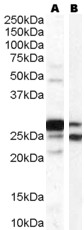 COMT Antibody - Staining of human testis lysate (35 ug protein in RIPA buffer) with A) COMT Antibody (aa170-183) (0.03 ug/ml) and B) COMT Antibody (aa52-65) (1 ug/ml). Primary incubation was 1 hour. Detected by chemiluminescence.