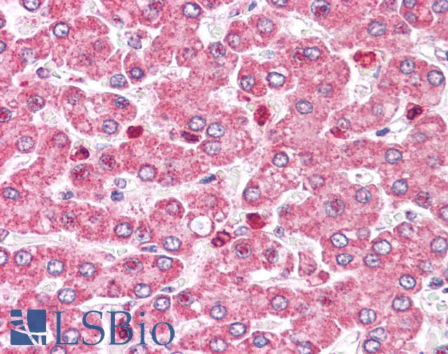 COMT Antibody - Anti-COMT antibody IHC of human liver. Immunohistochemistry of formalin-fixed, paraffin-embedded tissue after heat-induced antigen retrieval.